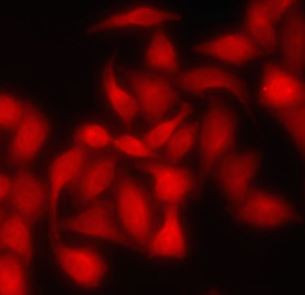 Anti-HIP1 / Huntingtin Interacting Protein