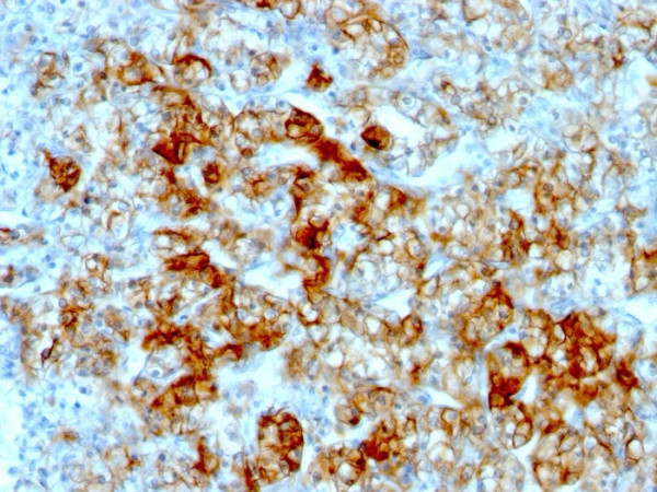 Anti-Ksp-Cadherin (Kidney-Specific Cadherin) / CDH16, clone SPM594