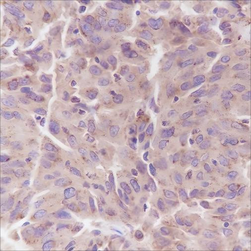 Anti-Recombinant PI3 Kinase p85 alpha, clone A332