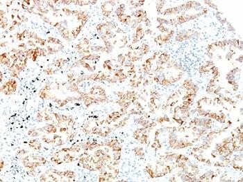 Anti-Cytokeratin 7, clone SPM270