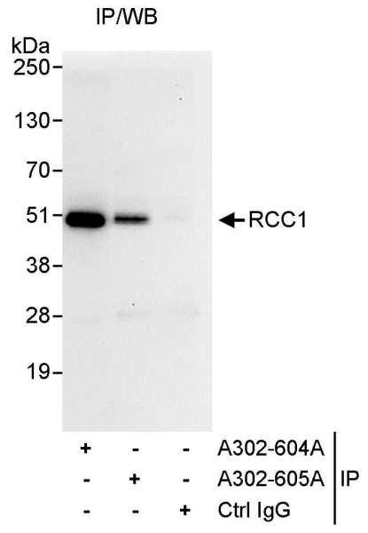 Anti-RCC1