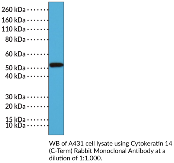 Anti-Cytokeratin 14 (C-Term) Rabbit Monoclonal Antibody (Clone RM328)