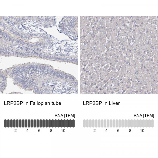 Anti-LRP2BP