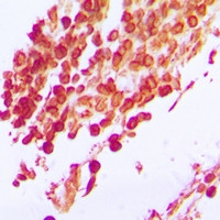 Anti-IFRD1