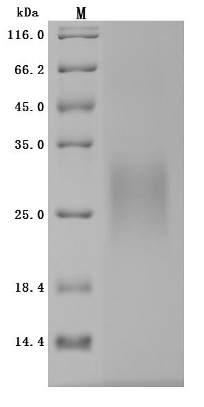 IGF-like family receptor 1 (IGFLR1), partial (Active), human, recombinant