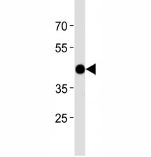 Anti-Zebrafish Atf4