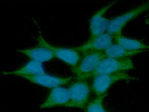 Anti-ST13 / Hip, clone 5C6