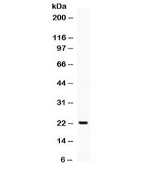 Anti-Granulocyte-Colony Stimulating Factor / CSF3