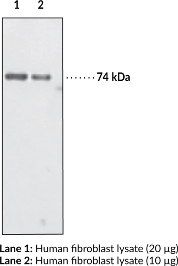 Anti-Optineurin (INT)