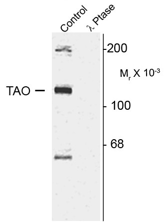 Anti-phospho-TAO2 (Ser181)
