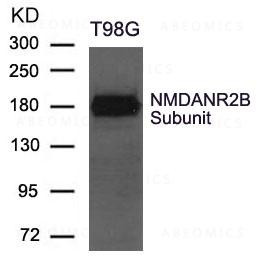 Anti-NMDANR2B Subunit