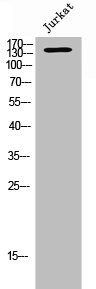Anti-SCAF8