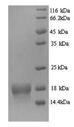 ATP synthase subunit delta, mitochondrial (ATP5D), human, recombinant