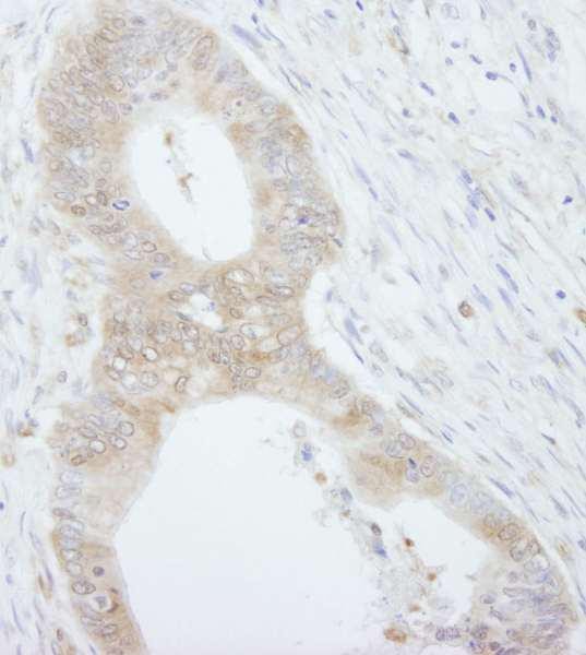 Anti-4EBP1 (IHC)