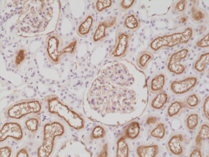 Anti-CD10 (human), Rabbit Monoclonal (RM337)