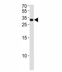 Anti-ASCL1 (MASH1)