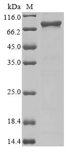 Three-prime repair exonuclease 1 (TREX1), human, recombinant