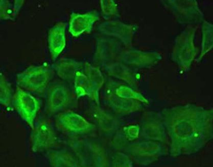 Anti-Myotilin