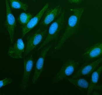 Anti-PDLIM4 / PDZ and LIM domain protein 4