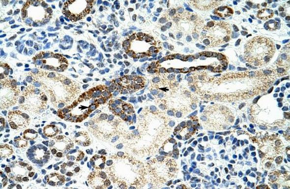 Anti-hnRNP F