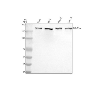 Anti-POLR1A / DNA-directed RNA polymerase I subunit RPA1