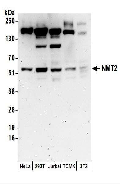 Anti-NMT2