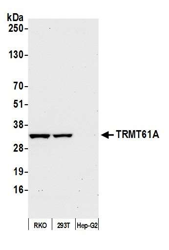 Anti-TRMT61A