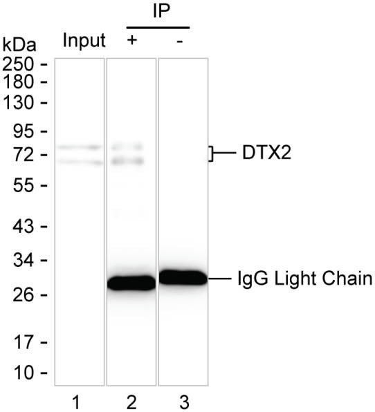 Anti-DTX2 Magnetic Beads