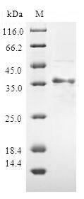 ATP synthase-coupling factor 6, mitochondrial (ATP5J), human, recombinant