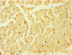 Anti-CASP1