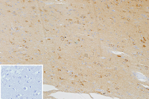 Anti-CXCR5 (Marker of T Follicular Helper (Tfh) Cells), clone CXCR5/13100