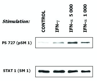 Anti-STAT1, clone SM1