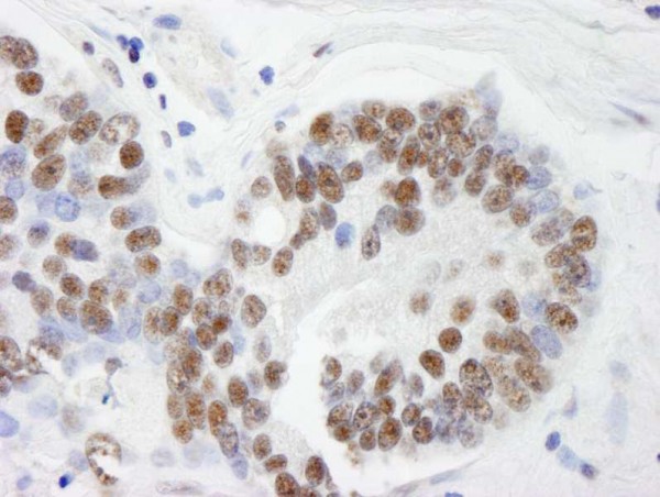 Anti-THRAP3/TRAP150 (IHC)