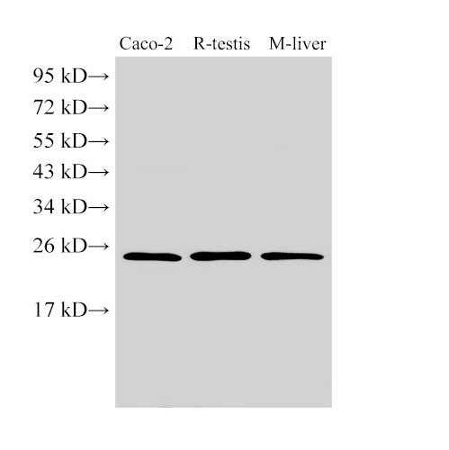 Anti-GSTA1