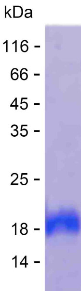 Recombinant Human MTHFR Protein