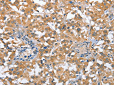 Anti-TP53BP2