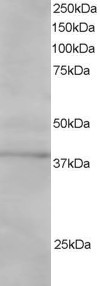 Anti-SAE1 / AOS1, C-terminal