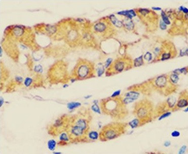 Anti-Beclin-1