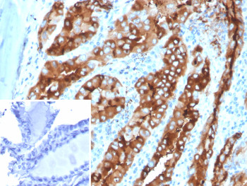 Anti-TG / Thyroglobulin, clone TGB/4582R