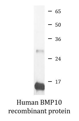 Human BMP10 recombinant protein (Active)