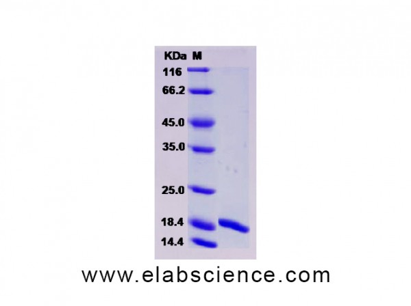 Recombinant Human G-CSF / CSF3 Protein (isoform b)