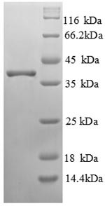 RING-box protein 2 (RNF7), human, recombinant