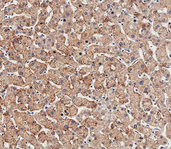 Anti-HSD17B13 / DHB13 / 7-beta hydroxysteroid dehydrogenase 13
