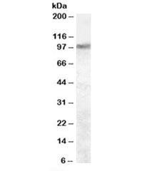 Anti-Trpv2