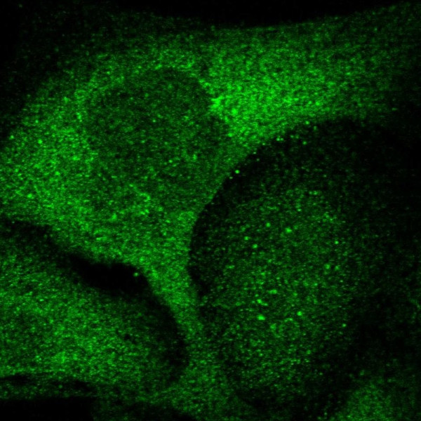 Anti-ZNF263