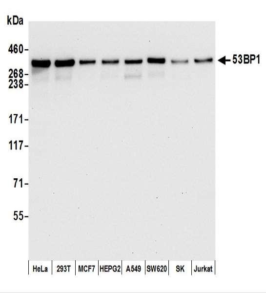 Anti-53BP1 Recombinant Monoclonal