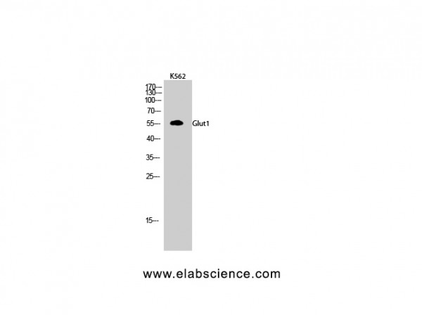Anti-Glut1