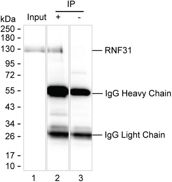 Anti-RNF31