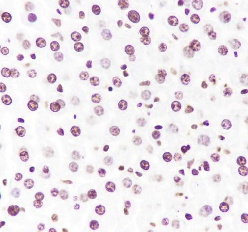 Anti-Recombinant Histone H3 (CT), clone A416