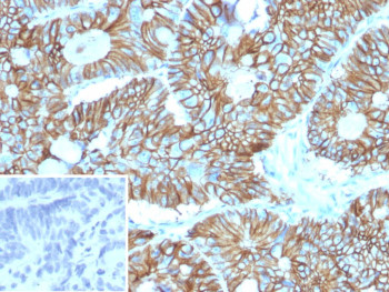 Anti-CDH17 / Cadherin 17, clone CDH17/2613